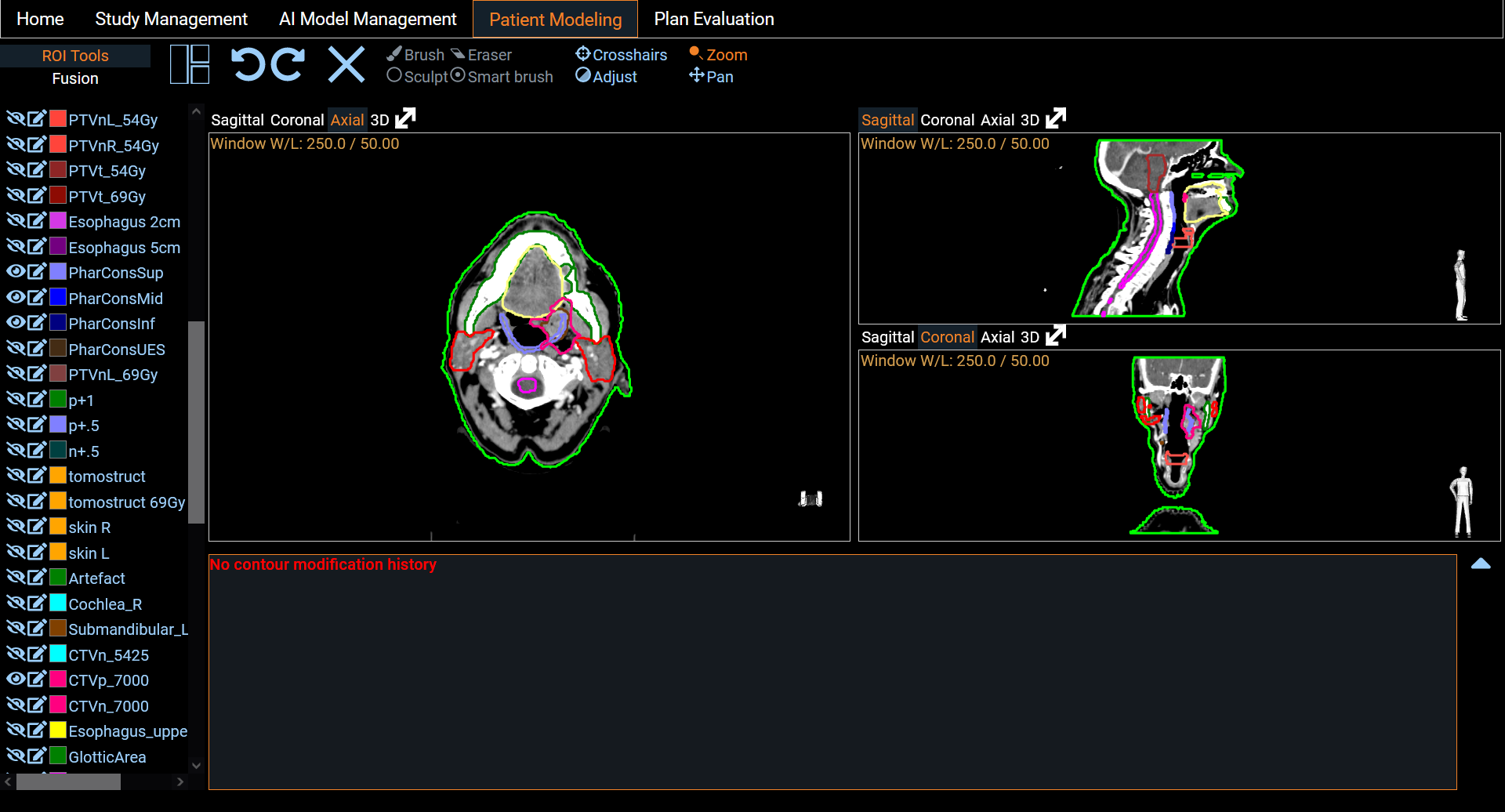 Patient Modeling Image