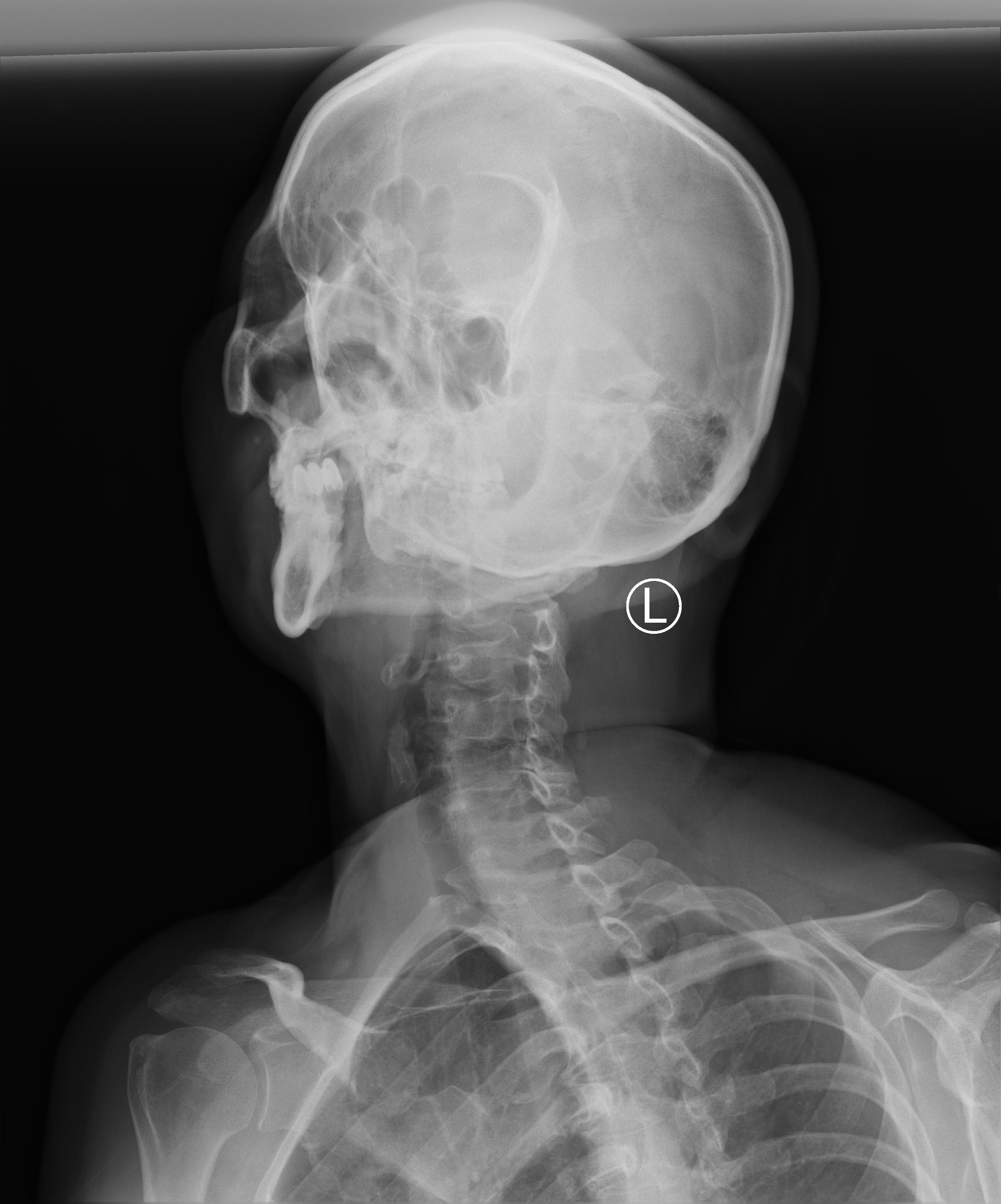 badaec3e4d5f382ebf0b51ba2c917cea.dicom.jpeg